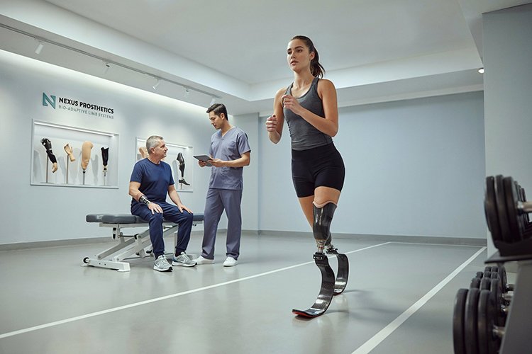 Amputee girl puts on carbon fiber prosthetic feet to prepare for rehabilitation training.